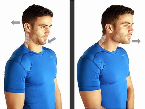 10 Effective, Quick and Easy Exercises to Get Rid of Neck Pain Fast ...