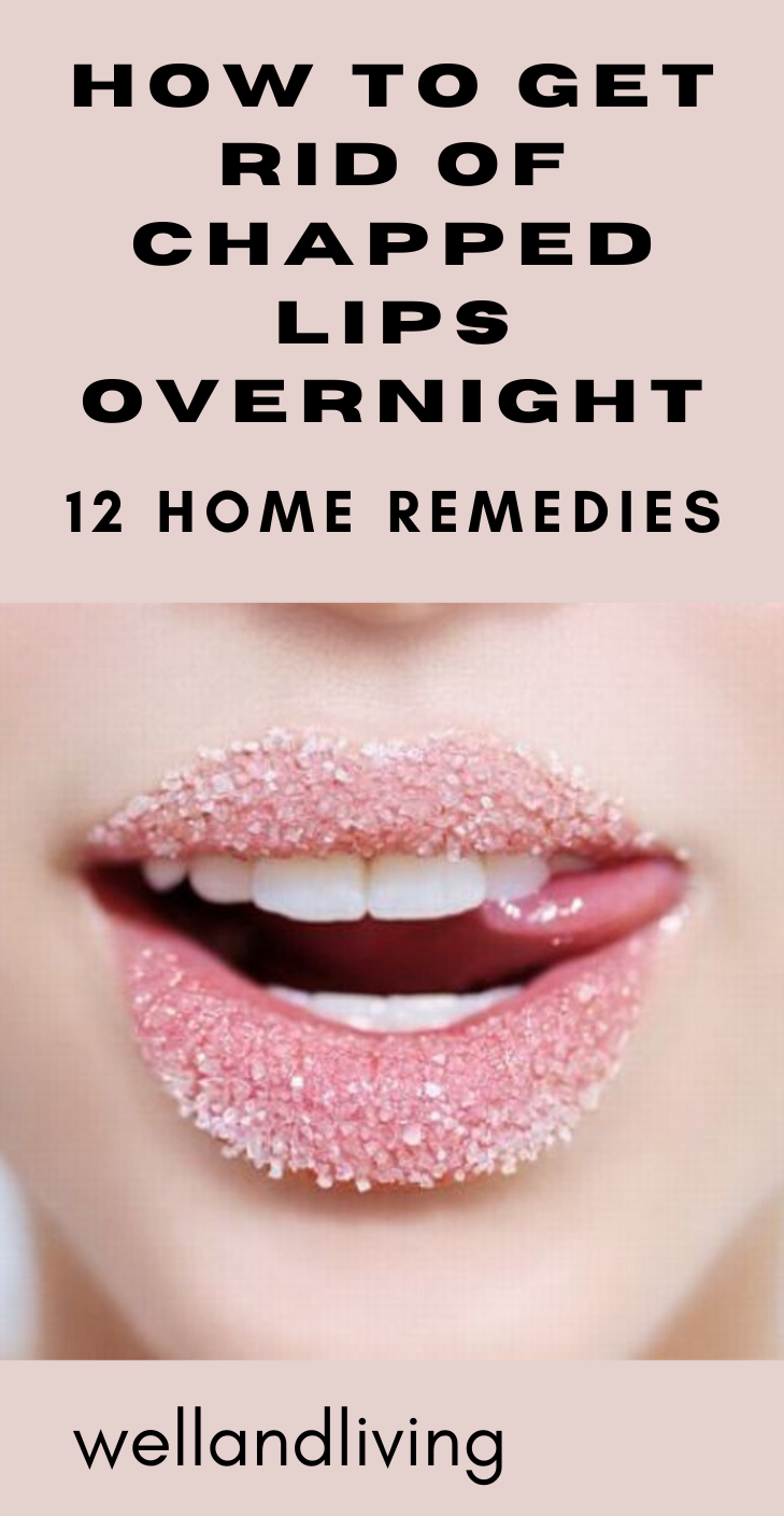 12 Home Remedies To Get Rid Of Chapped Lips Overnight Saayla 1129